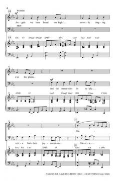 Angels We Have Heard on High 