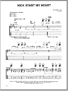 Kick Start My Heart von Motley Crue (Download) 