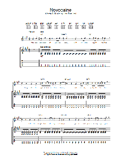 Novocaine von Bon Jovi (Download) 