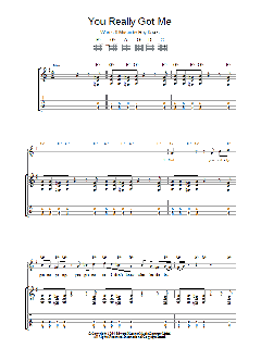 You Really Got Me (Download) 