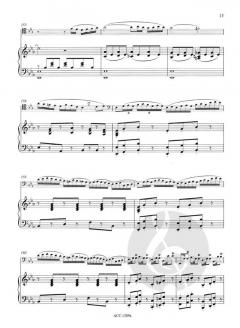 Ant Steps On An Elephants Toe von Albert Mangelsdorff 