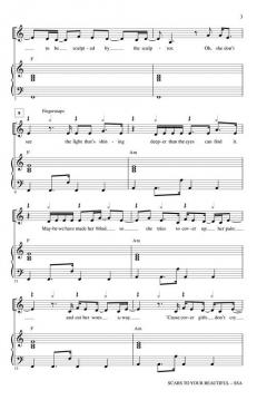 Scars To Your Beautiful (Alessia Cara) 